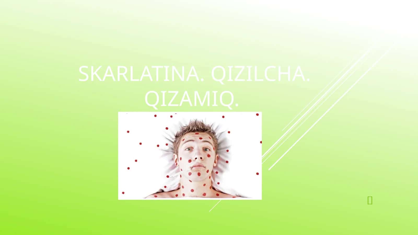 Qizamiqkasalligi, Qizilchakasalligi, Skarlatina 1