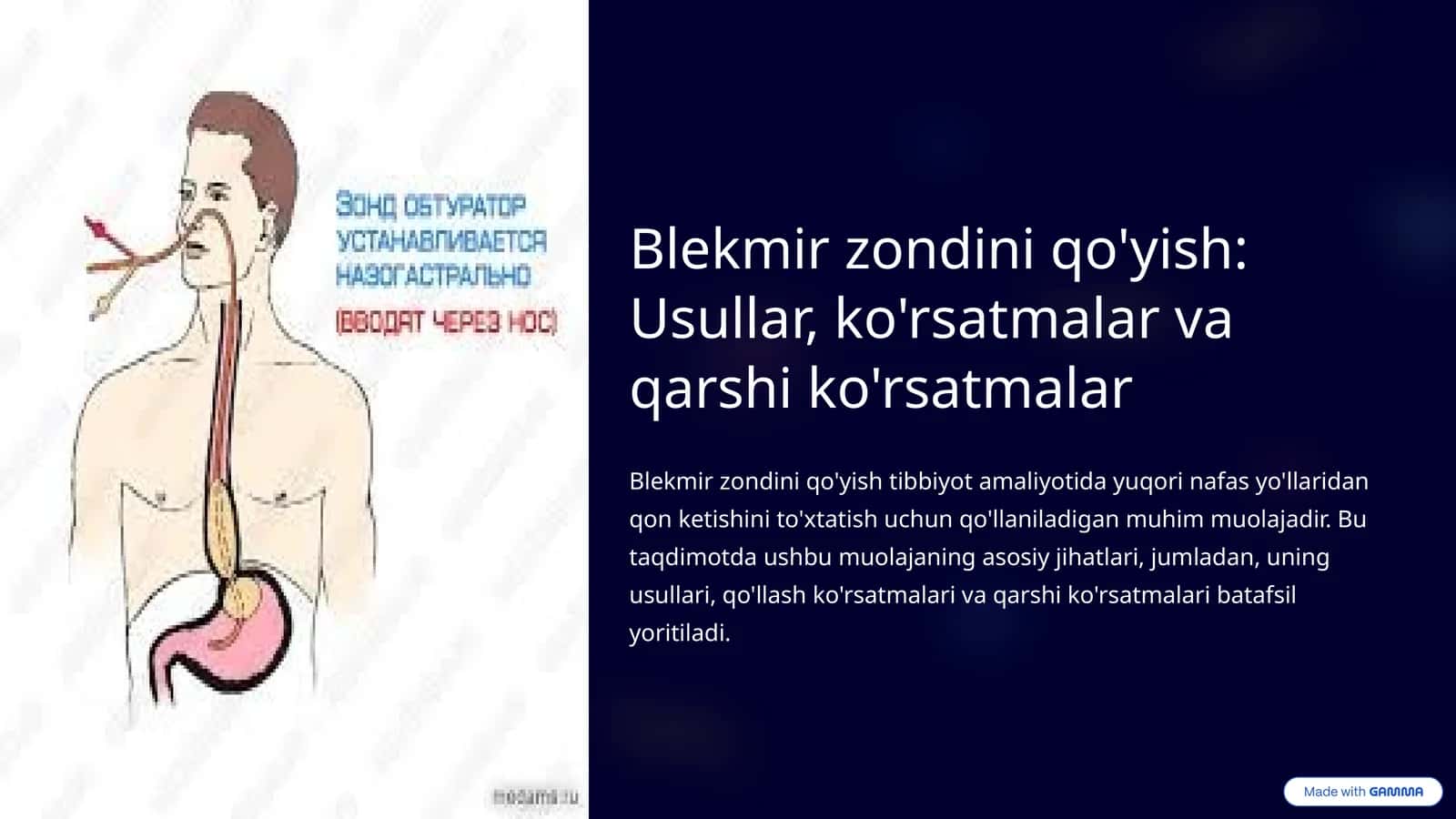 Blekmir zondini qo'yish: Usullar, ko'rsatmalar va qarshi ko'rsatmalar 1