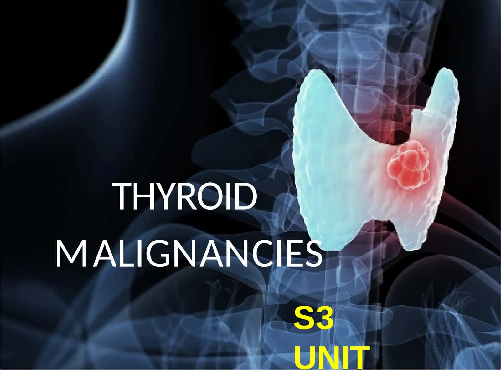 THYROIDMALIGNANCIES 1