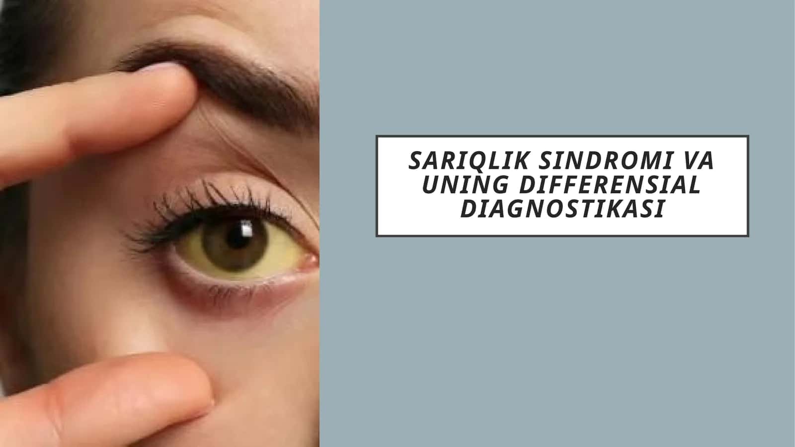 Sariqlik sindromi 1