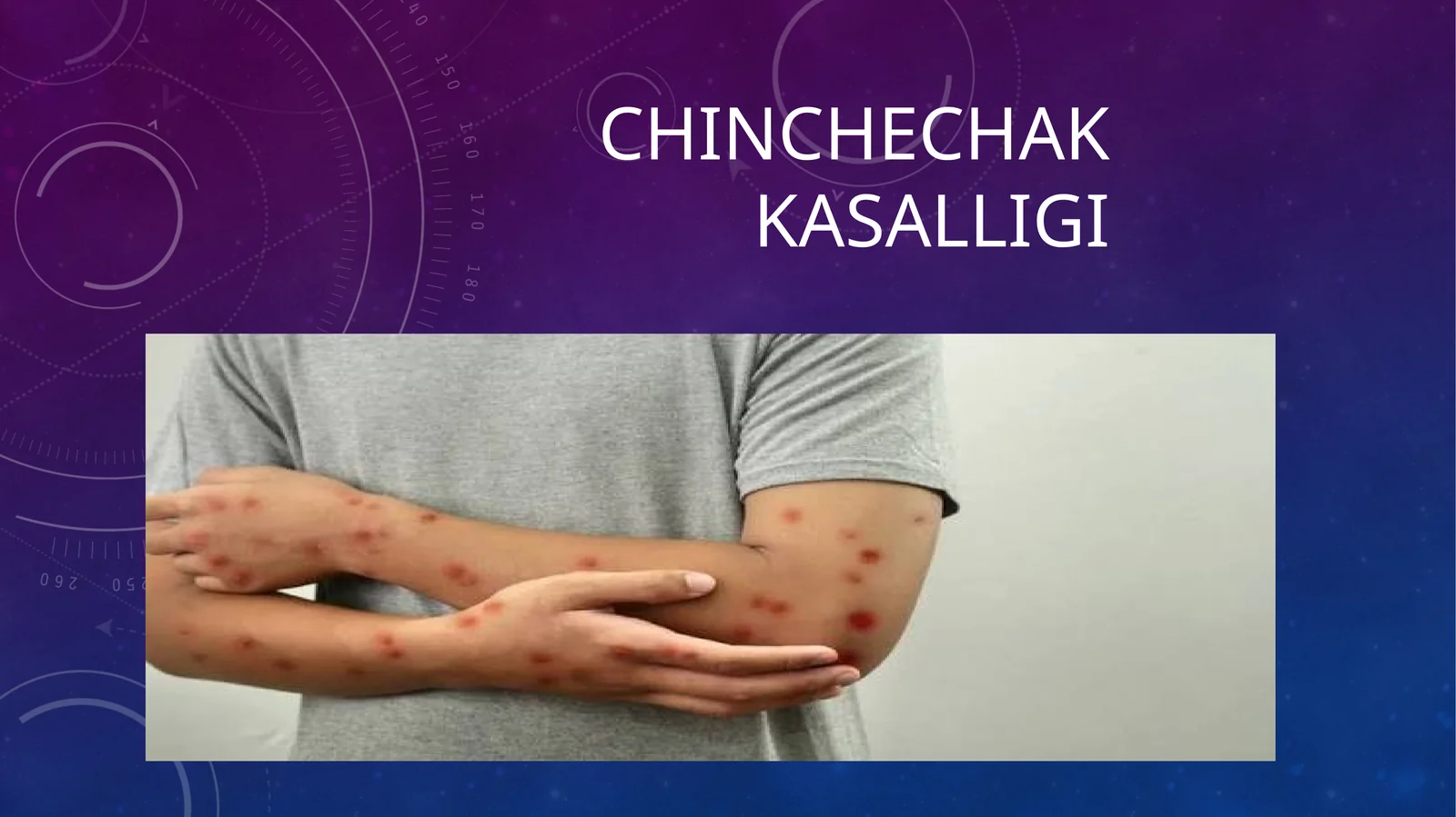 Chinchechak kasalligi 1