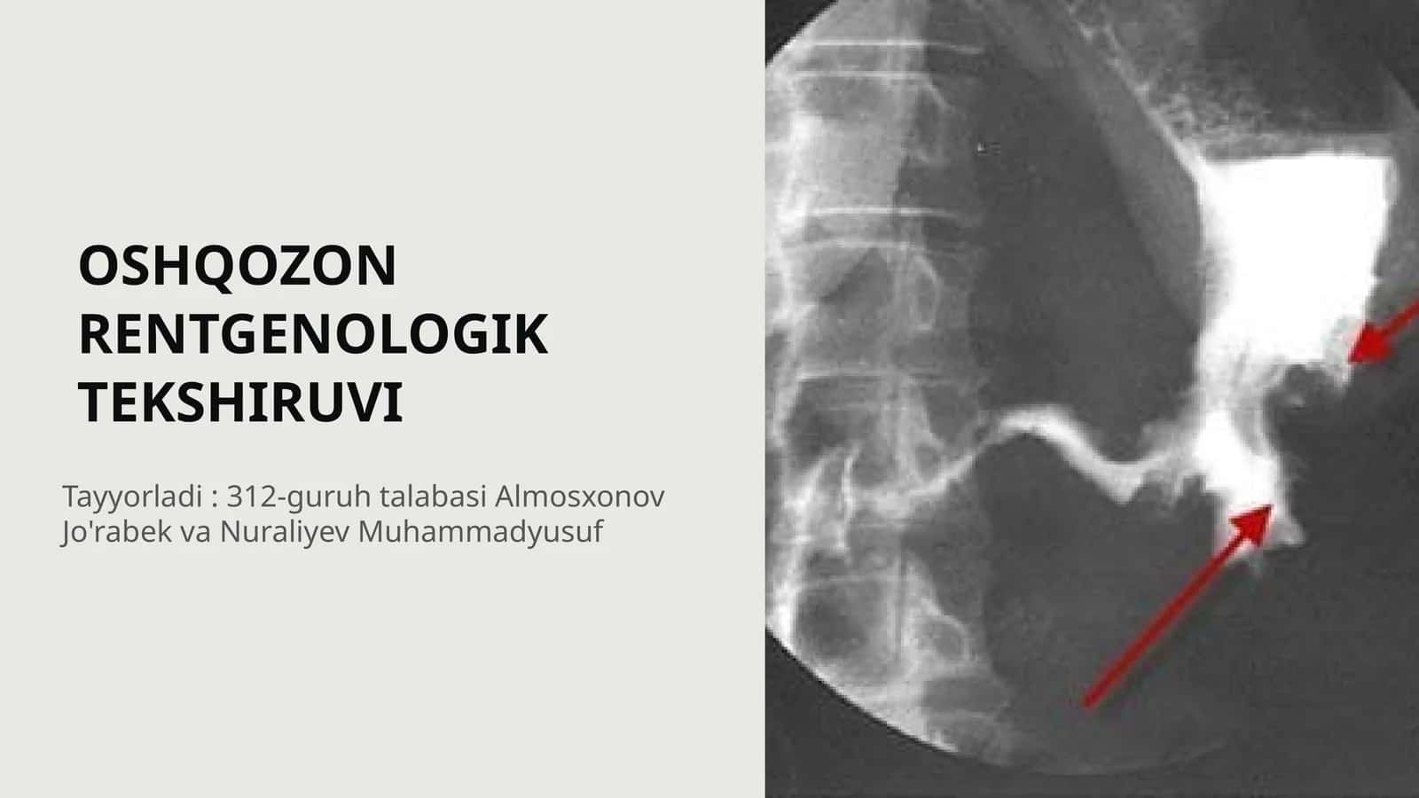 OSHQOZON RENTGENOLOGIK TEKSHIRUVI 1