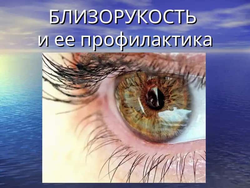 Близорукостьи ее профилактика 1