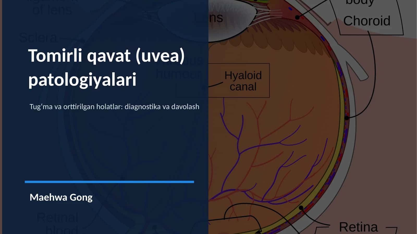 Tomirli qavat (uvea) 1