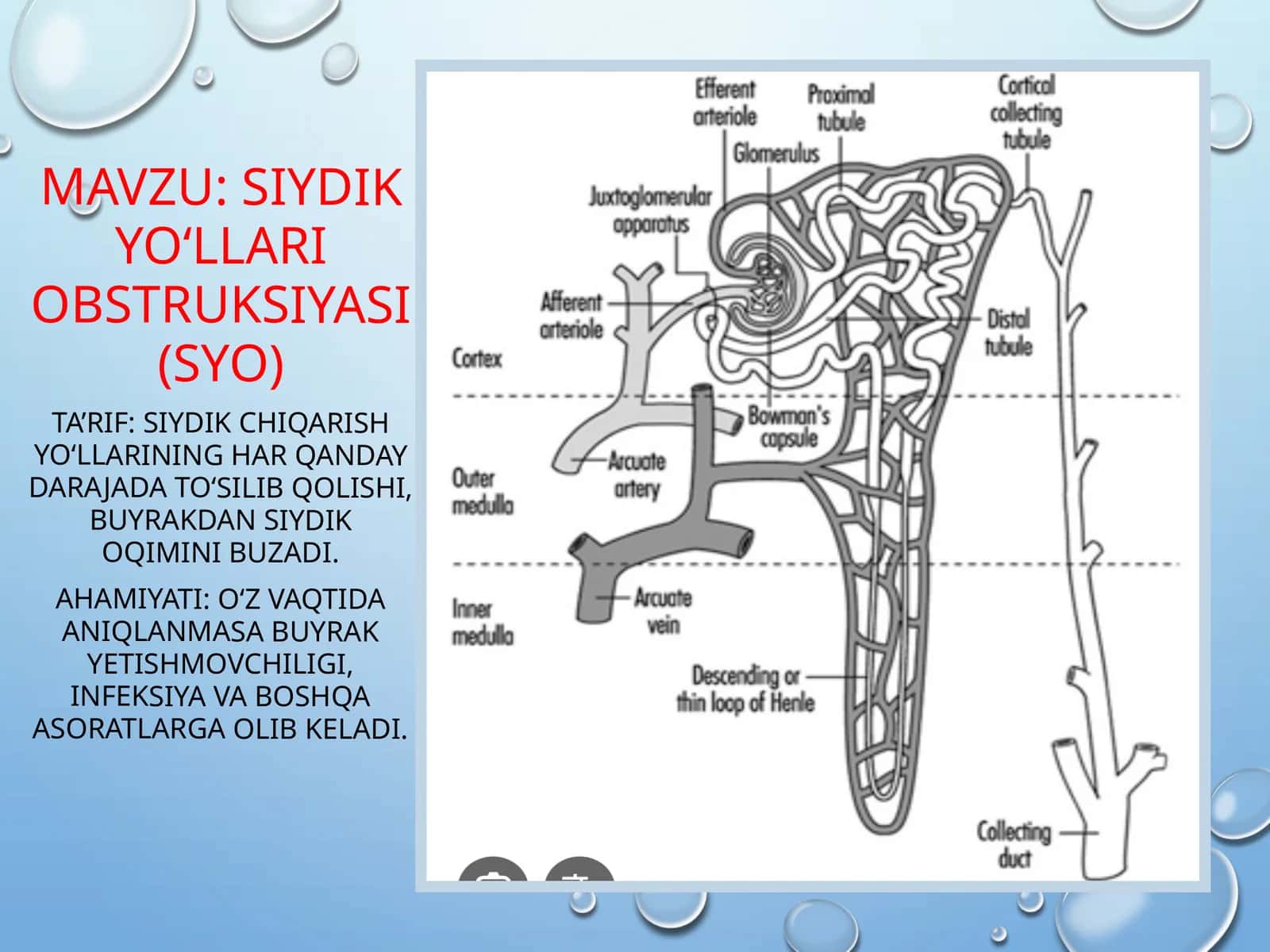 Siydik yo‘llari obstruksiyasi (SYO) 1