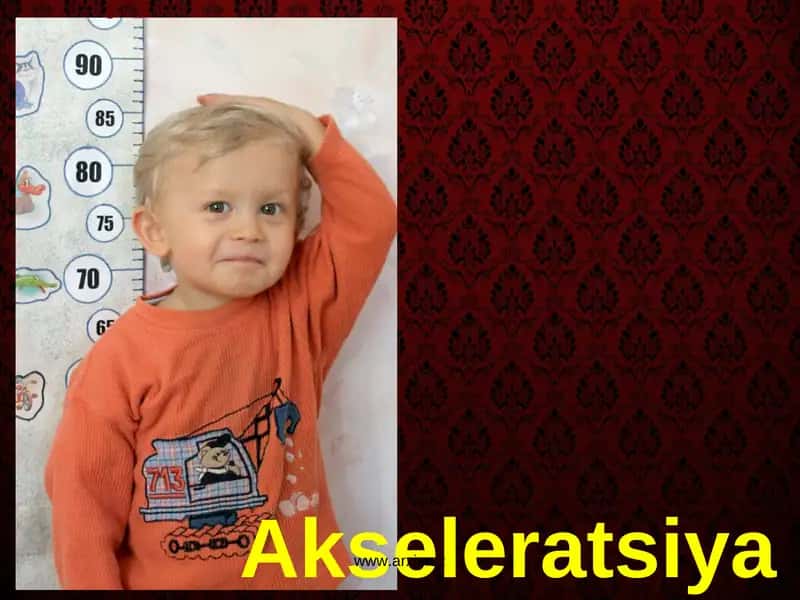 Akseleratsiya 1