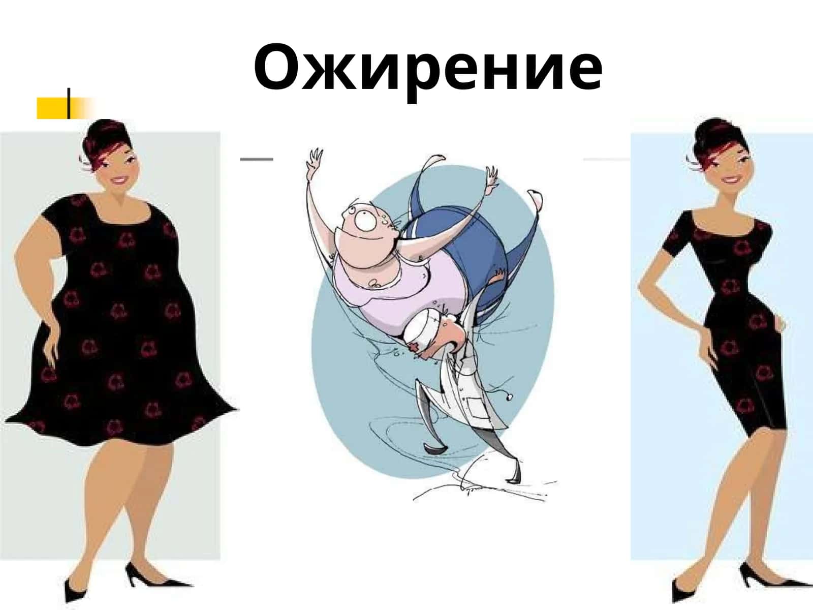 Ожирение 1