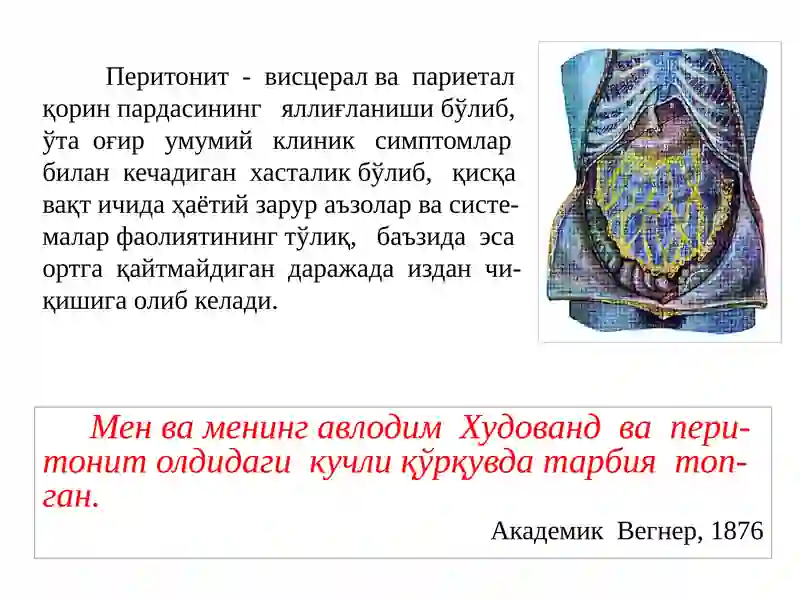 Ўткир перитонит