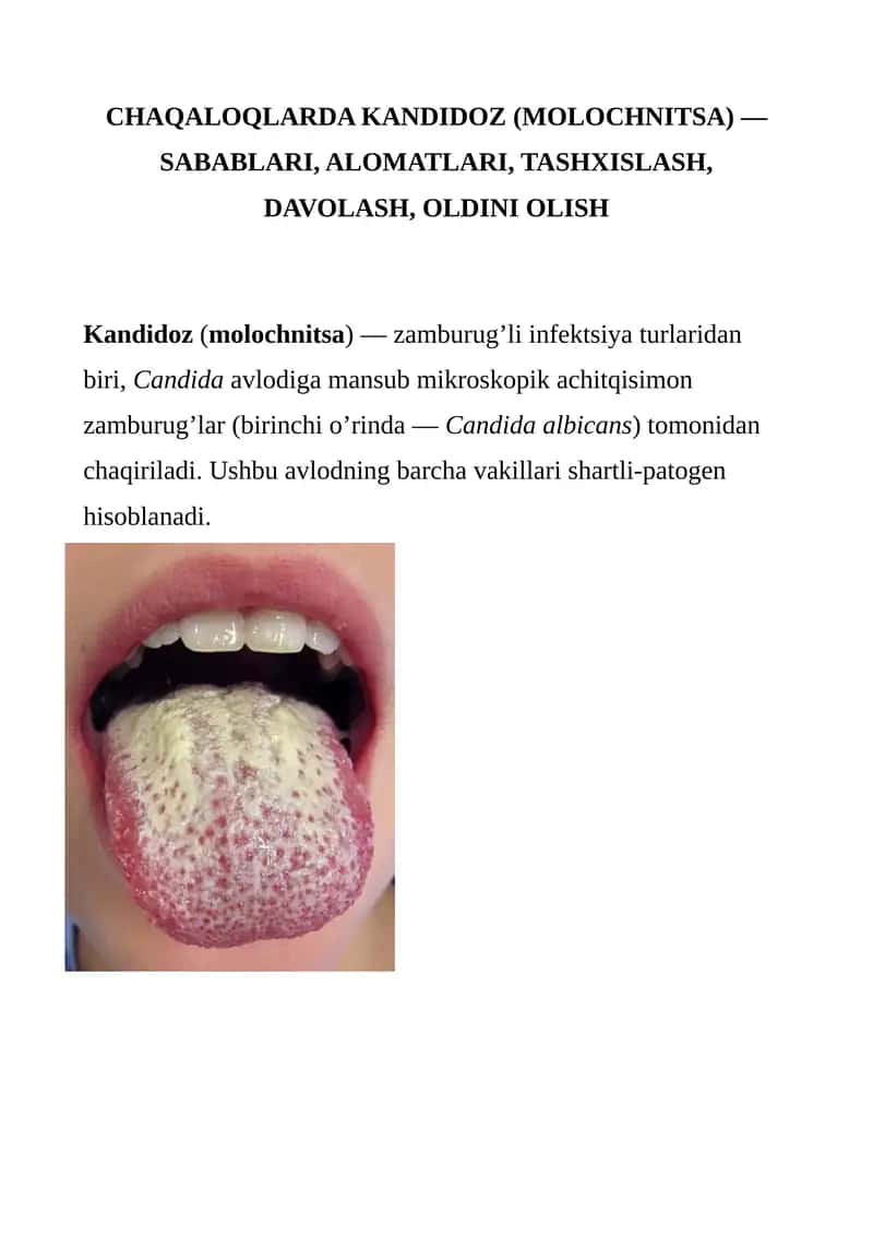 Kandidoz (Molochnitsa) 1