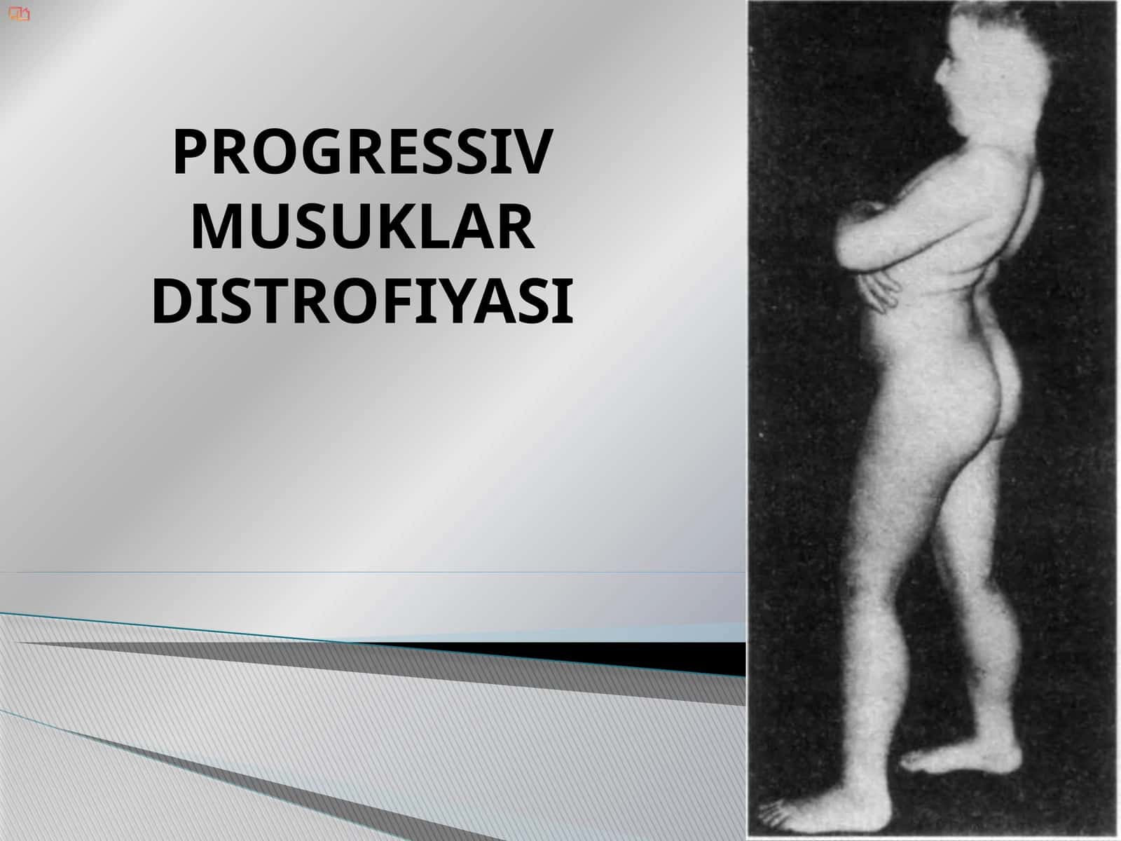 PROGRESSIV MUSUKLAR DISTROFIYASI 1