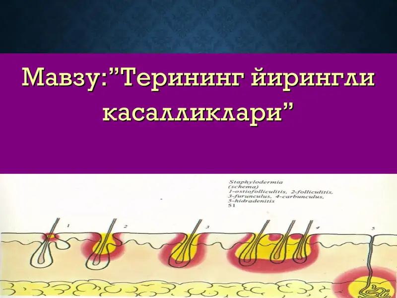 Терининг йирингли касалликлари 1
