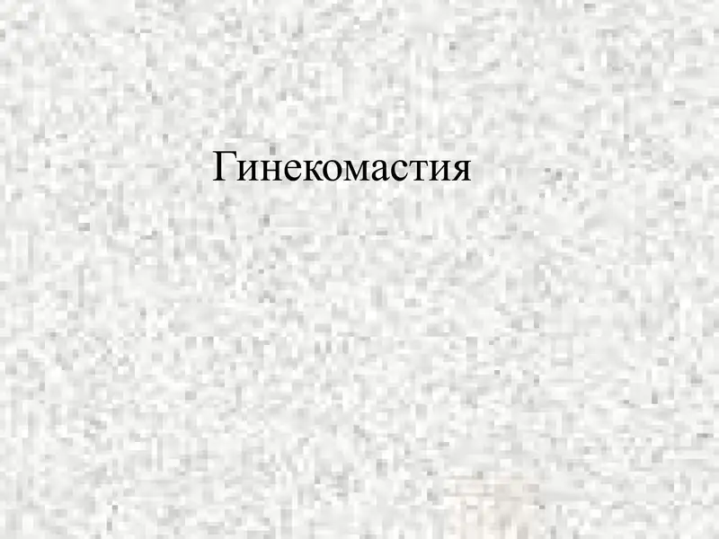 Гинекомастия 1