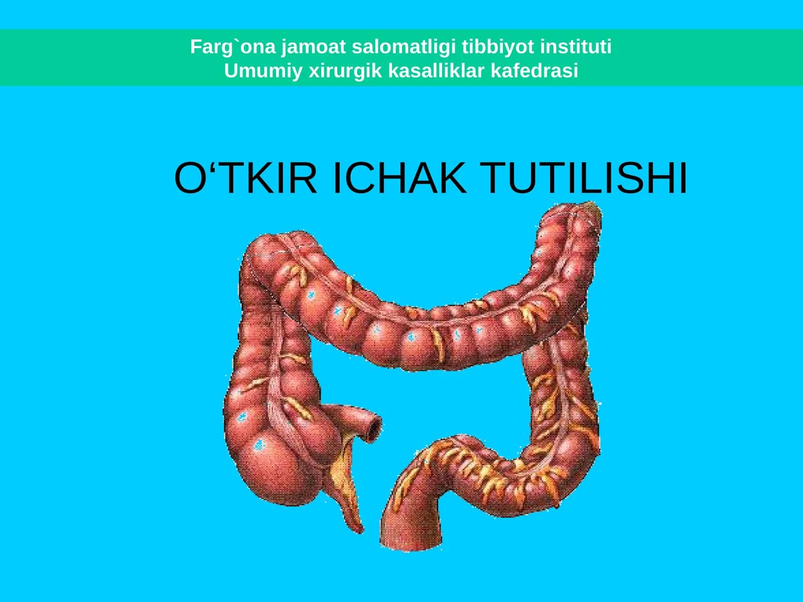 O‘TKIR ICHAK TUTILISHI 1