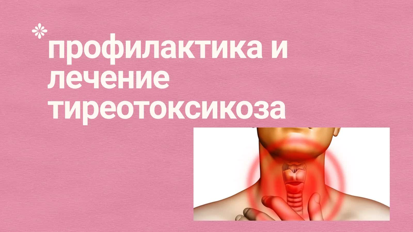 Профилактика и лечение тиреотоксикоза 1