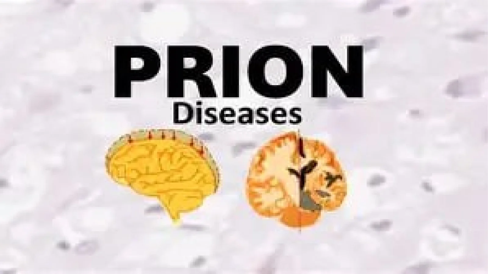 Prion Kasalliklari 1