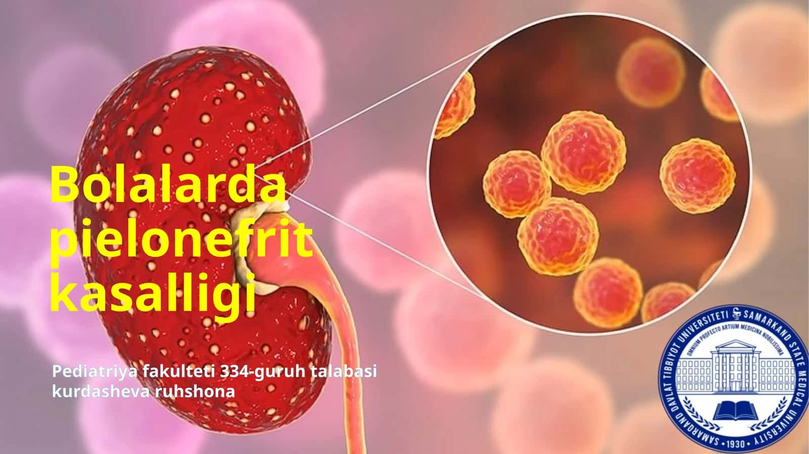 Bolalarda pielonefrit kasalligi 1