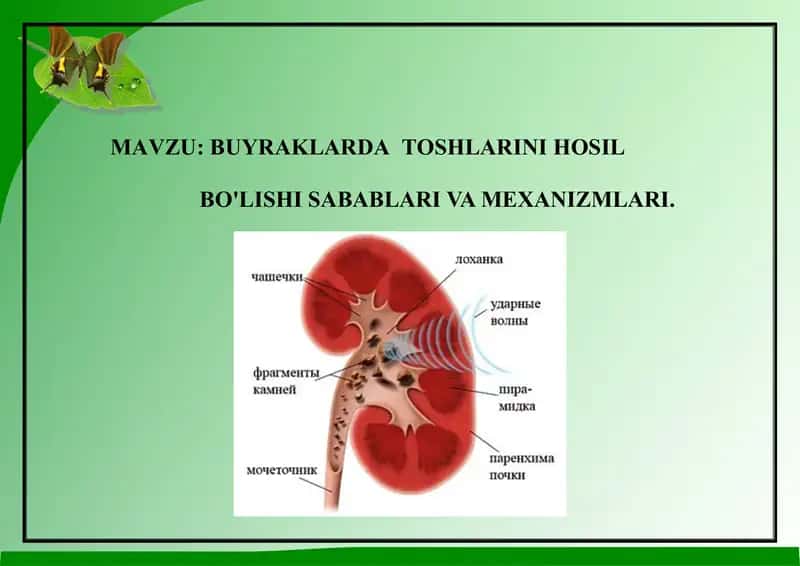 BUYRAKLARDATOSHLARINI HOSIL BO'LISHI SABABLARI VA MEXANIZMLARI 1