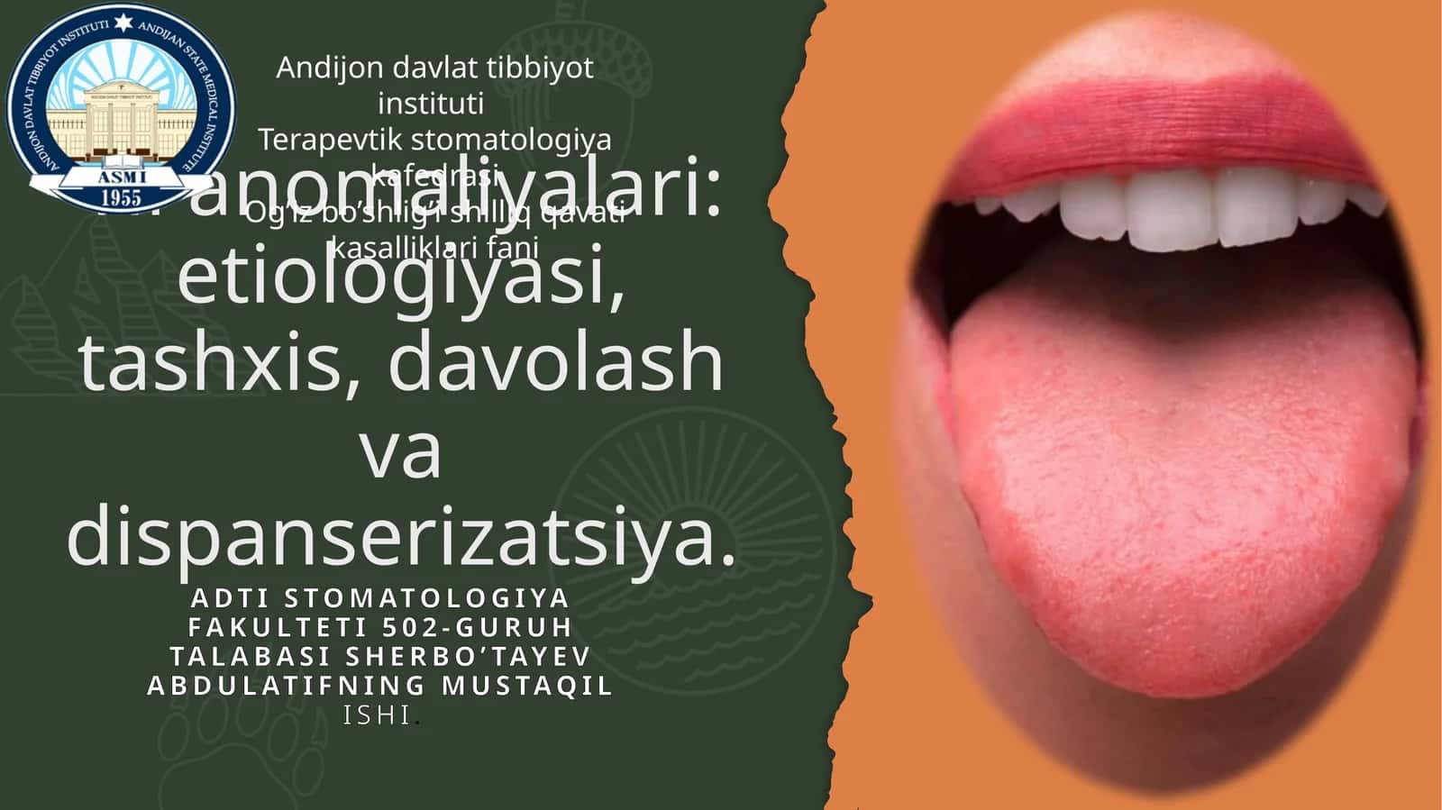 Til anomaliyalari: etiologiyasi, tashxis, davolash va dispanserizatsiya. 1