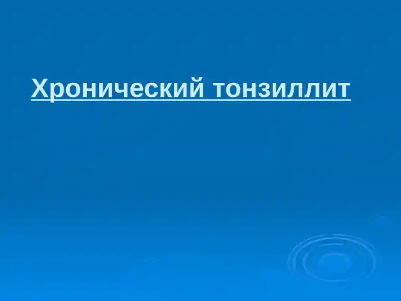 Хронический тонзиллит