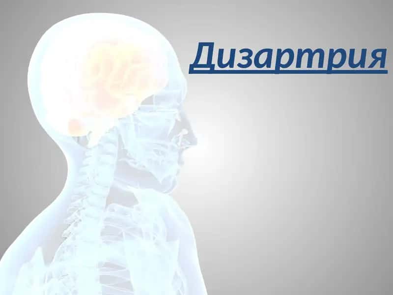 Дизартрия 1