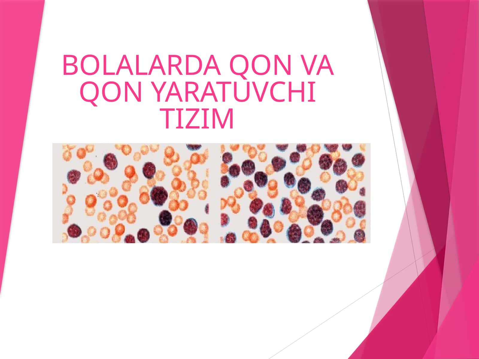 BOLALARDA QON VA QON YARATUVCHI TIZIM 1