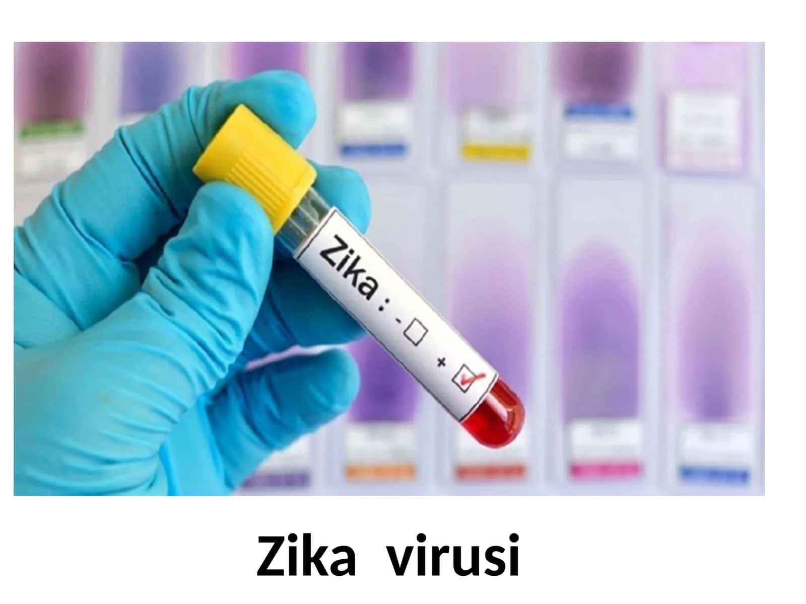 Zika virusi 1