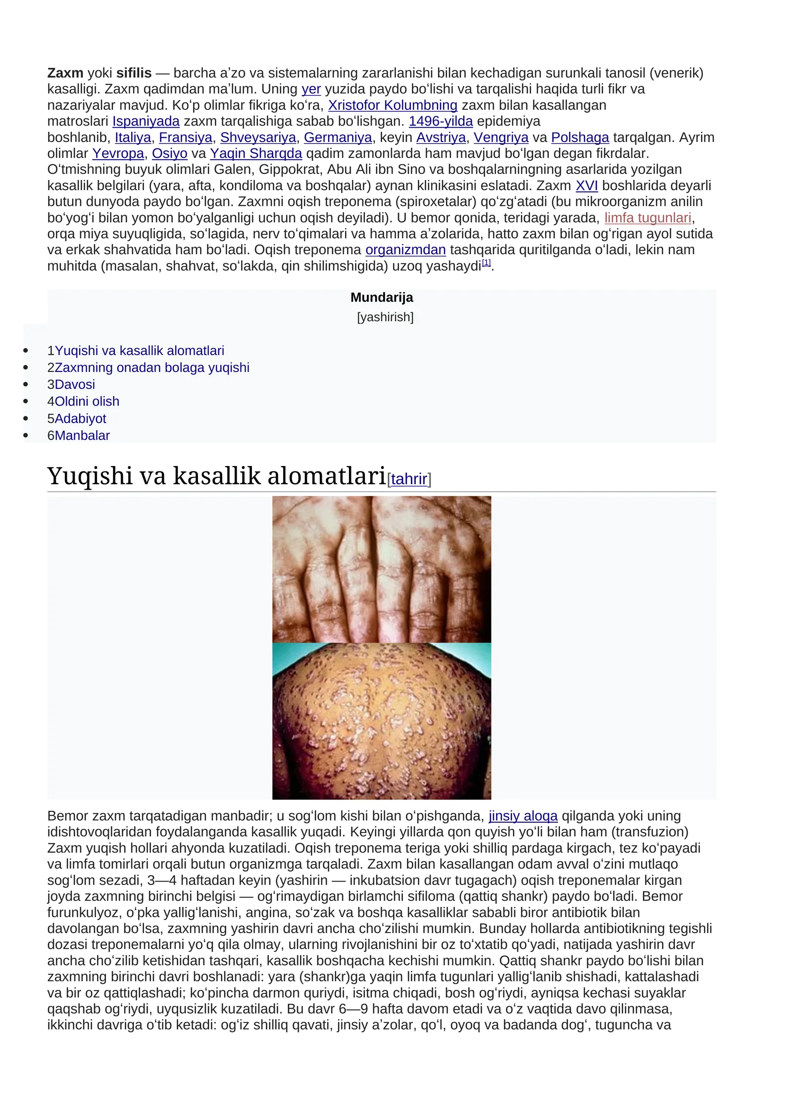 Zaxm kasalligi 1