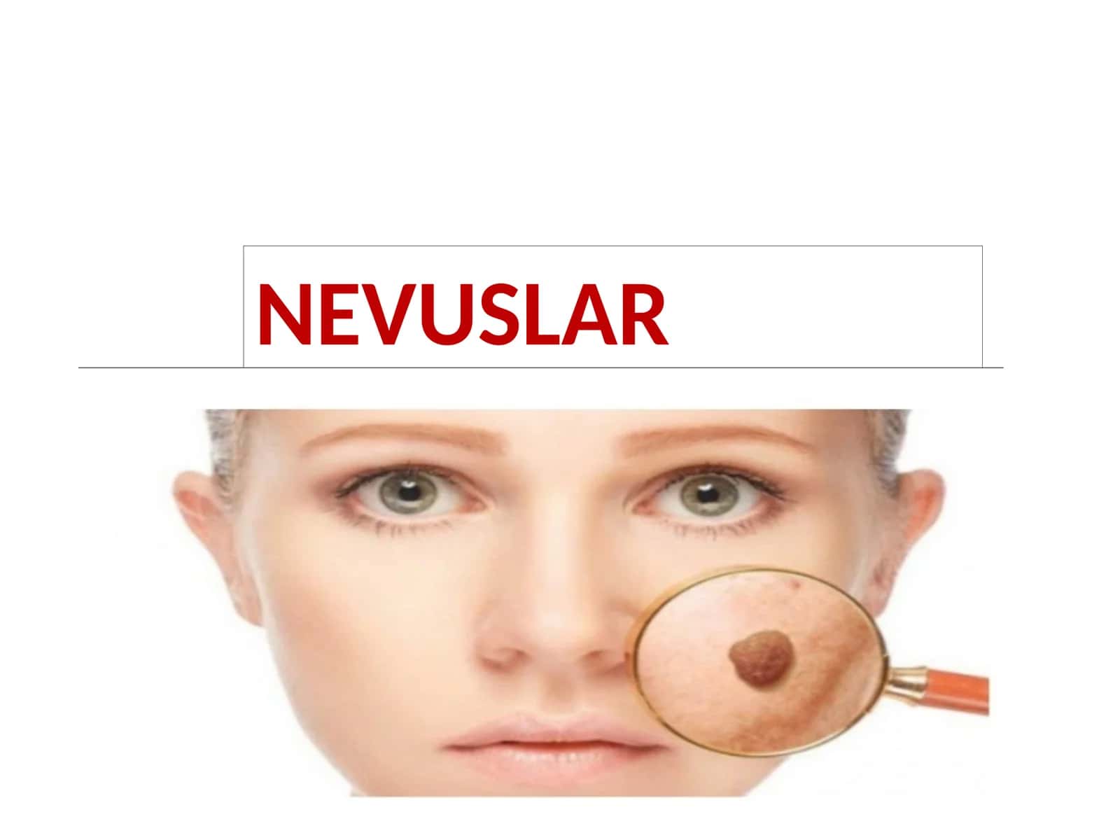 NEVUSLAR 1