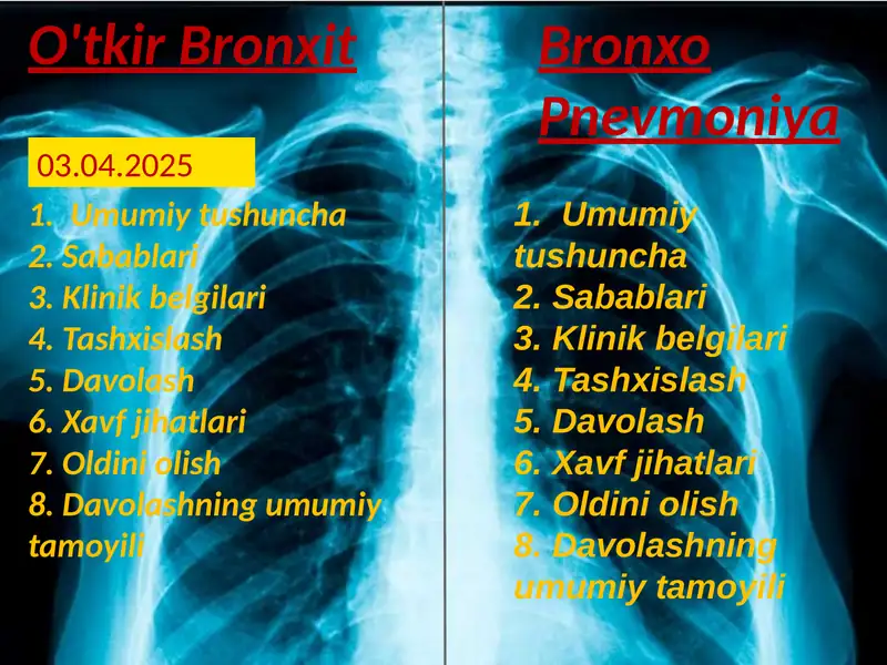 O'tkir bronxit 1