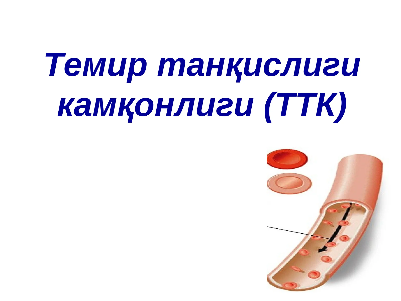 Темир танқислиги камқонлиги(ТТК) 1