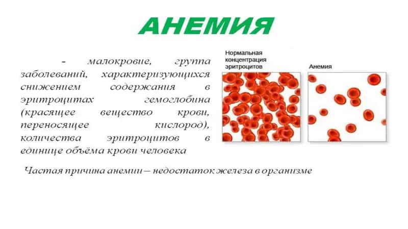 ANEMIYA 1