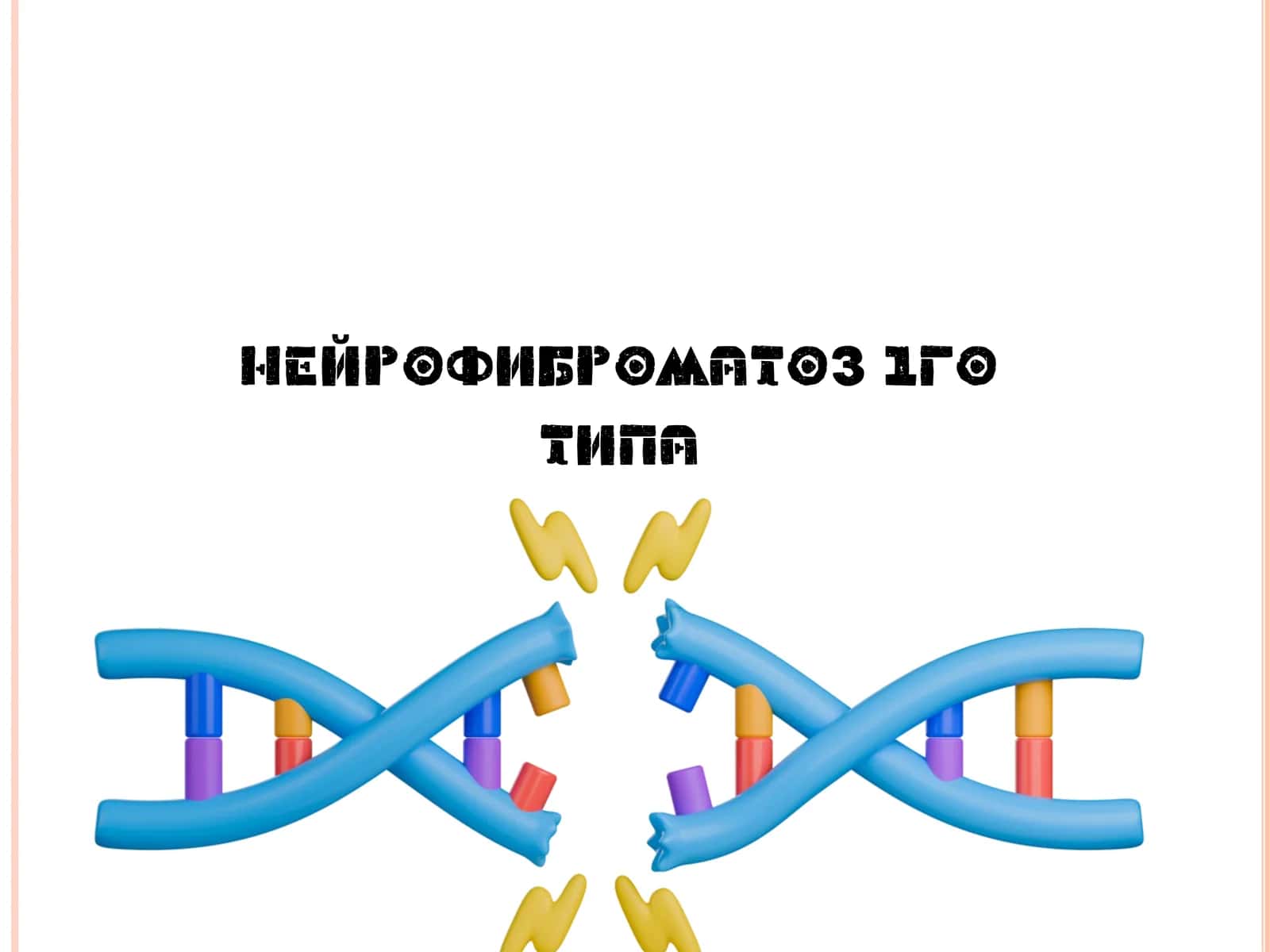 Нейрофиброматоз 1го типа 1