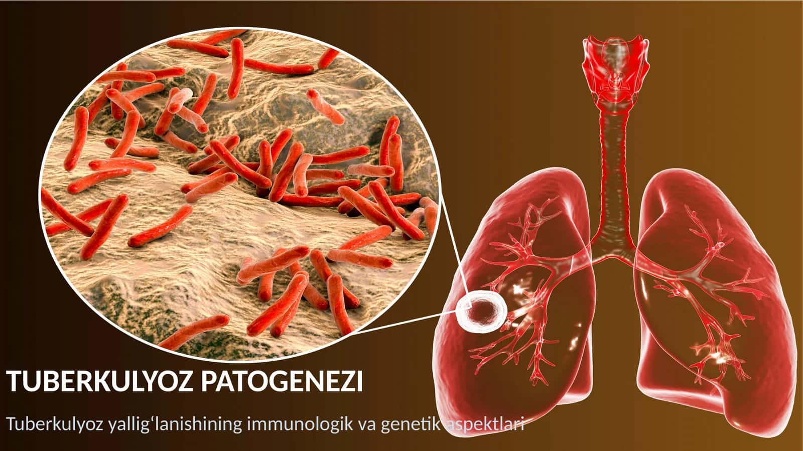 Tuberkulyoz patogenezi 1