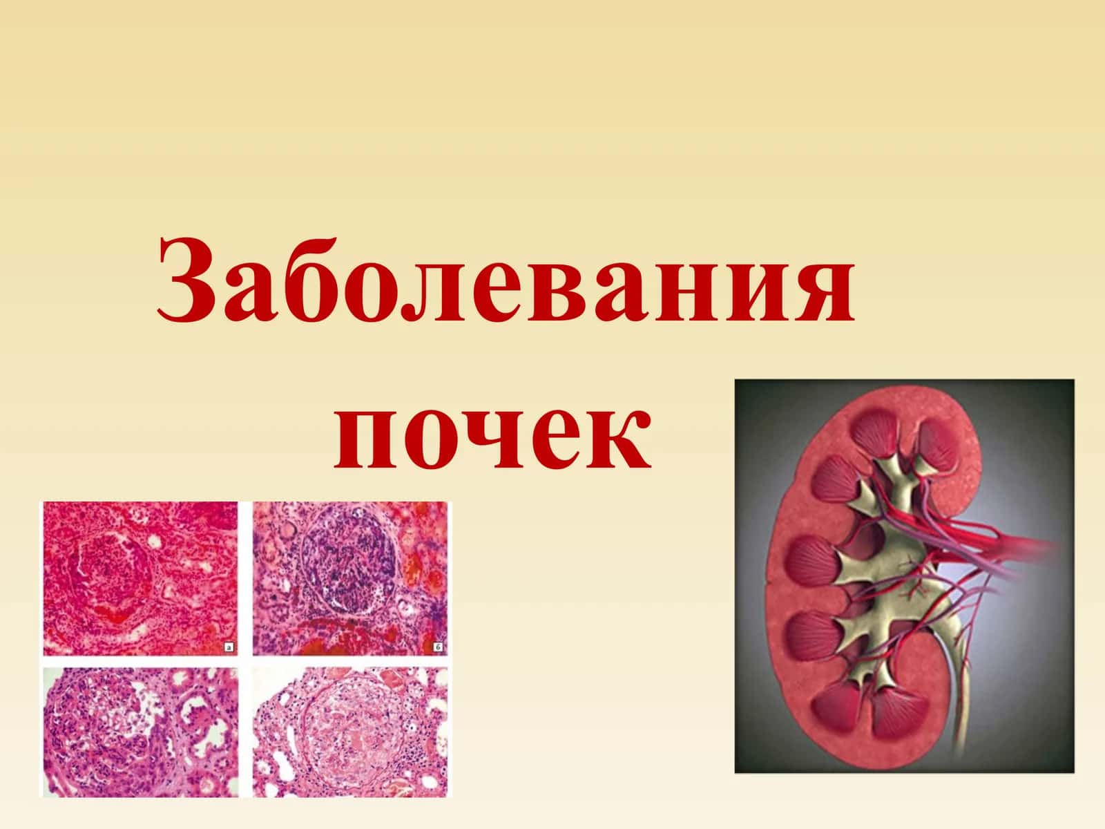 Патология почек 1