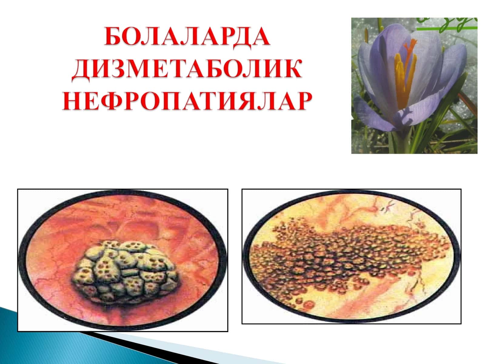 Буйрак касалликлари 1