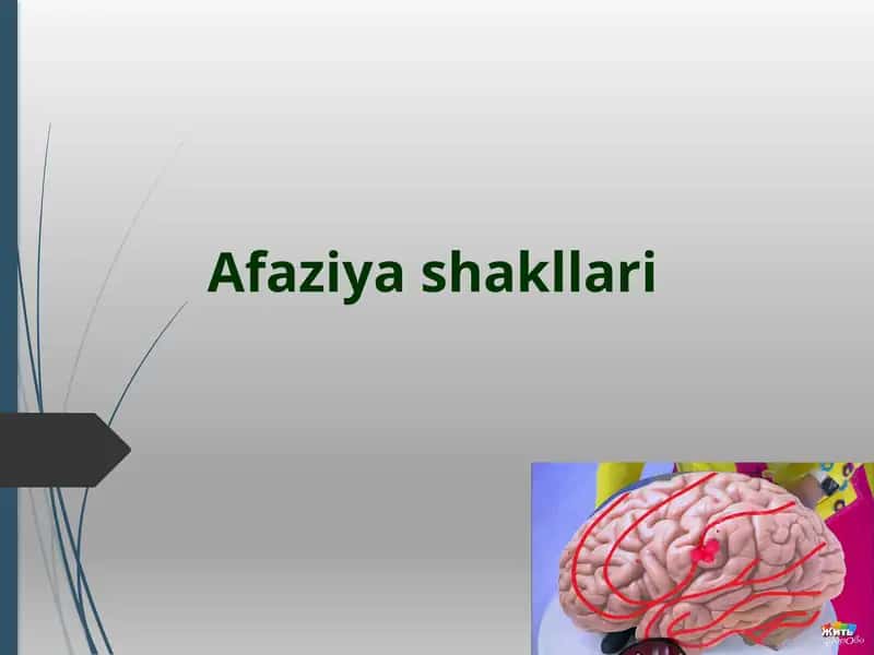 Аfaziyashakllari 1