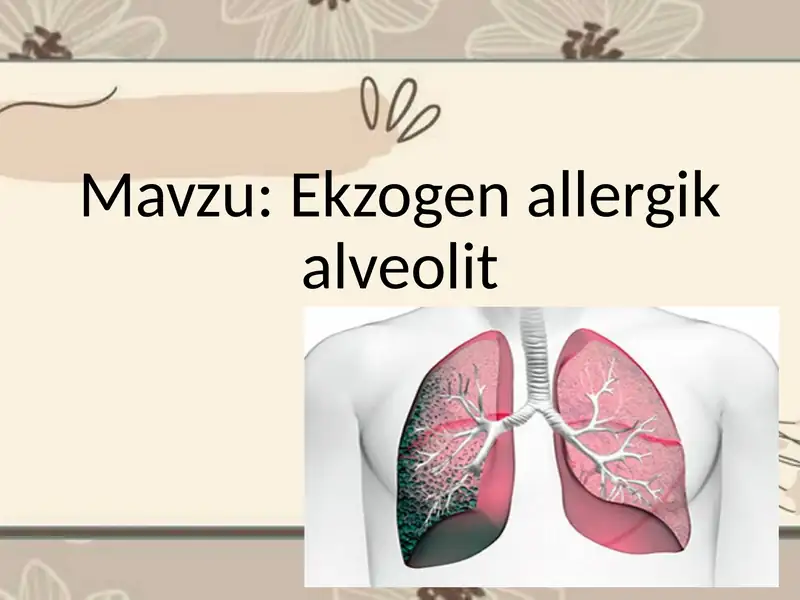 Ekzogen allergik alveolit 1