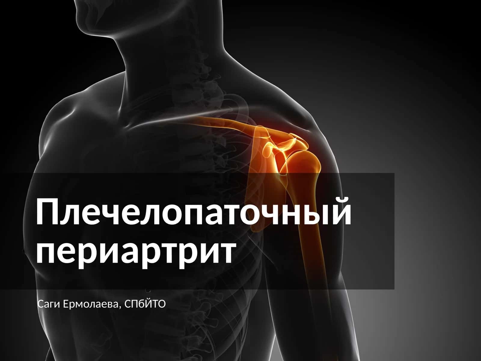 Плечелопаточный периартрит 1