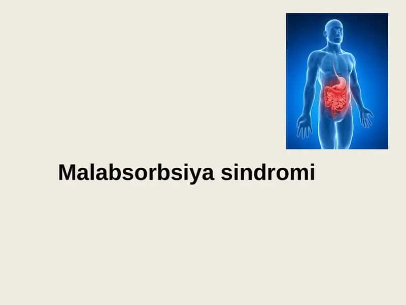 Malabsorbsiya sindromi 1