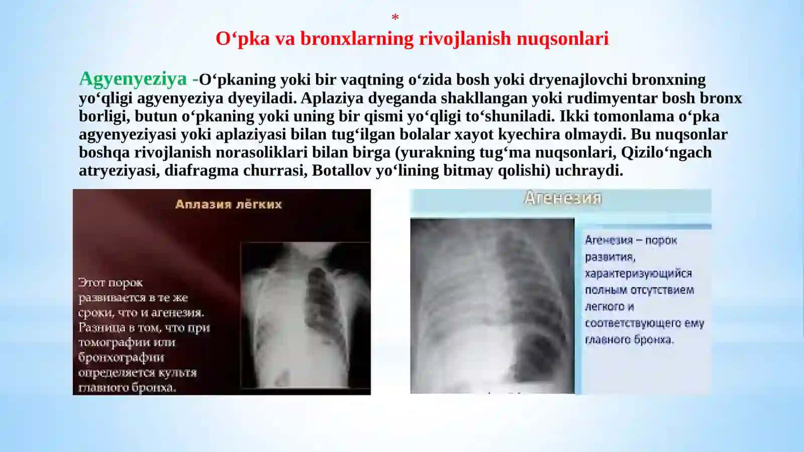 O’pkaning tug‘ma rivojlanish nuqsonlari va an’omali yalari 2
