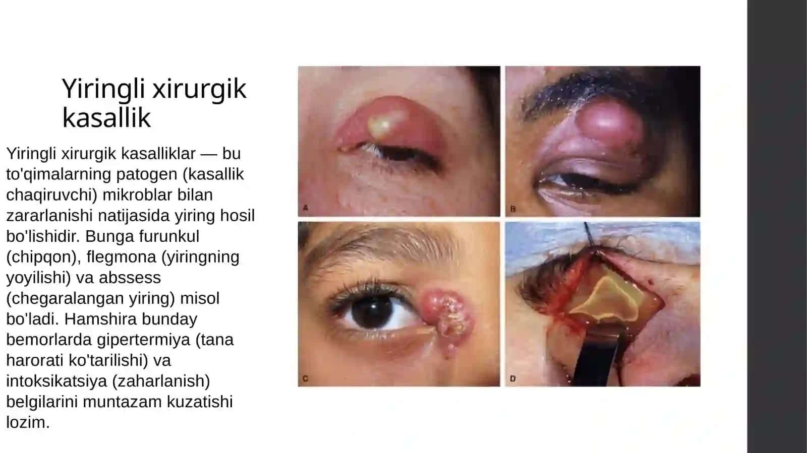 Tibbiyot kasbiga kirish mavzu: yiring elixirurgik bemorlarni parvarishlash 2