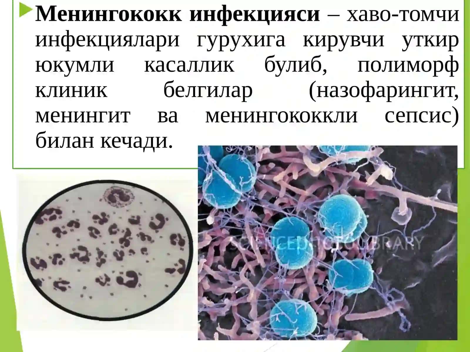 Менингококкли инфекцияэнцефалит ва полиомиелит патоморфологияси 2