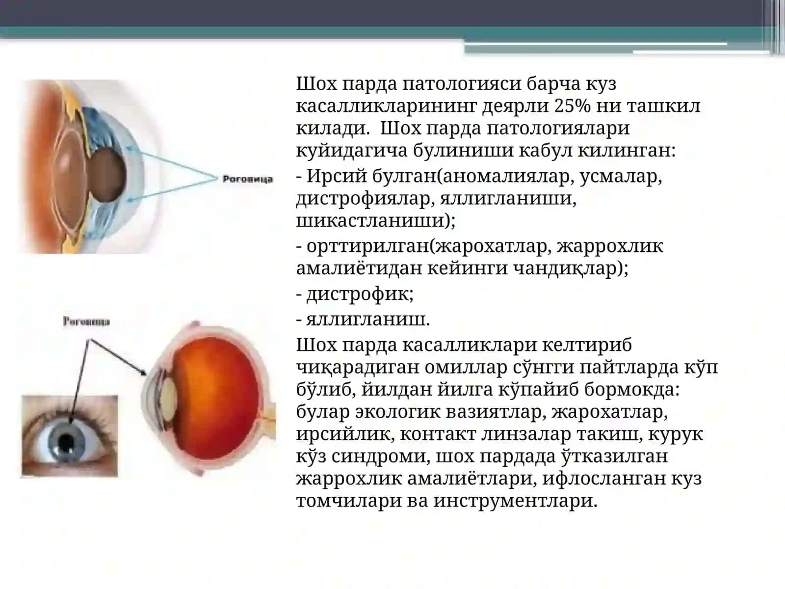 Шох парда касалликларининг, этиология ва патогенези, аномалияларивакератитларнидиагностикасивадавоси 2