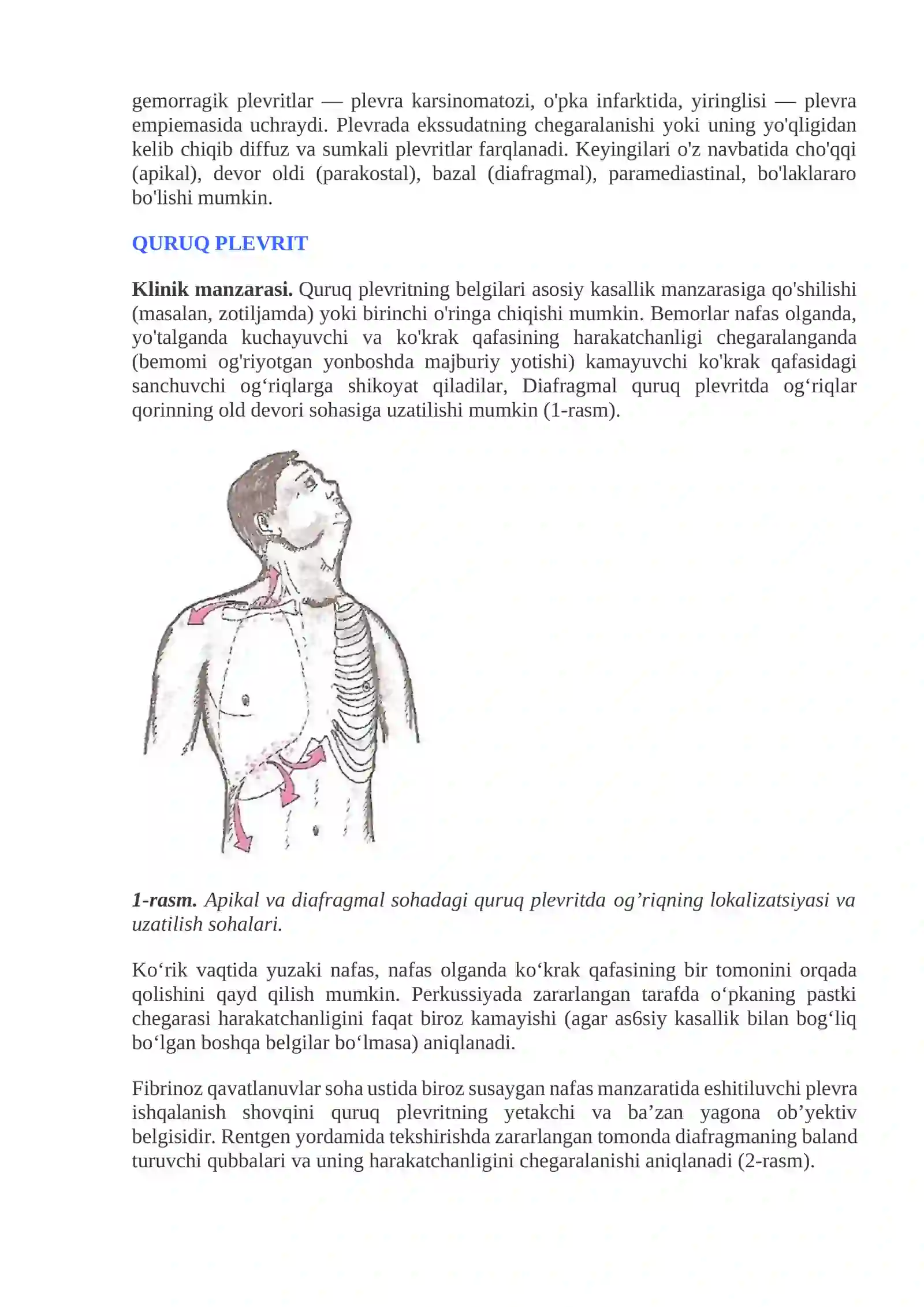 Plevritlar 2