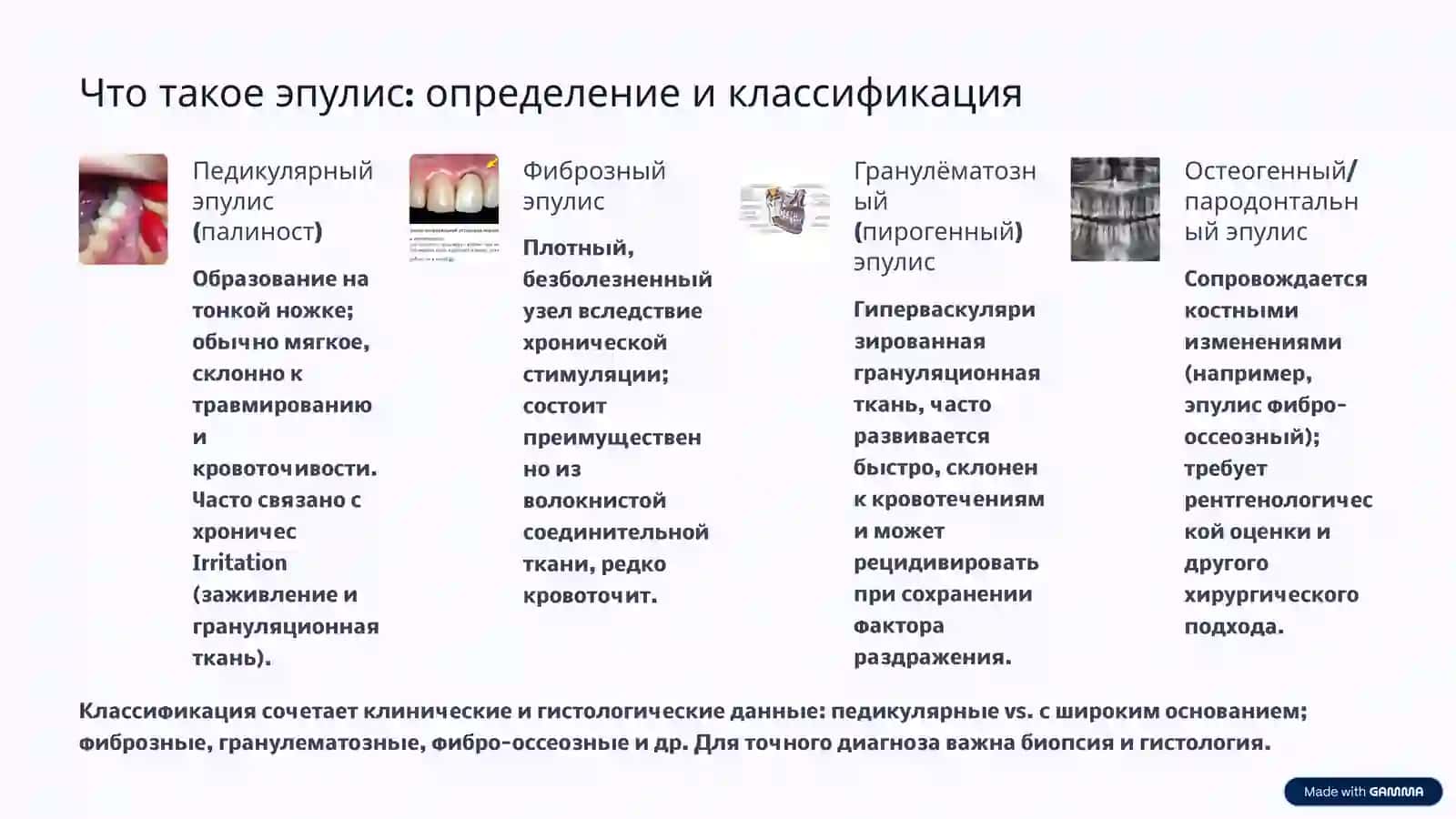 Cтроение и виды эпулисов: комплексный обзор 2
