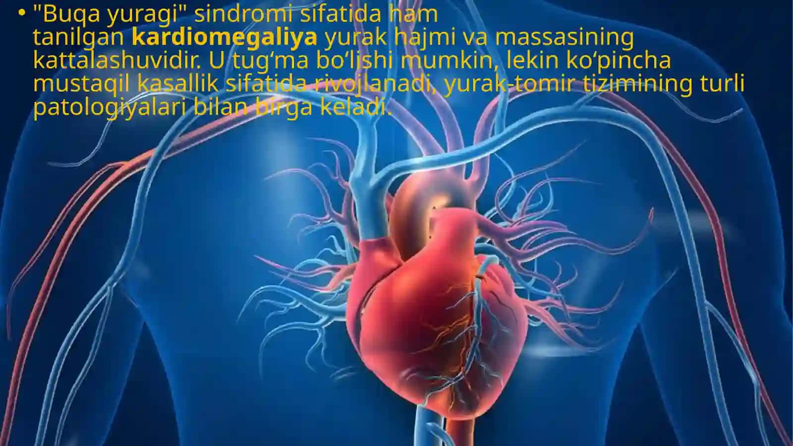 Kardiomegaliya 2