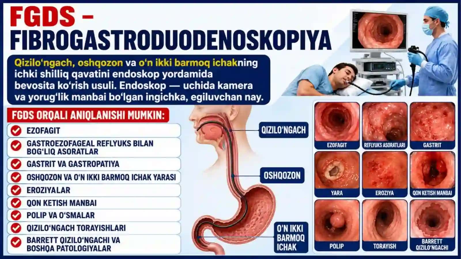 Ovqat hazm qilish tizimi kasalliklari 2