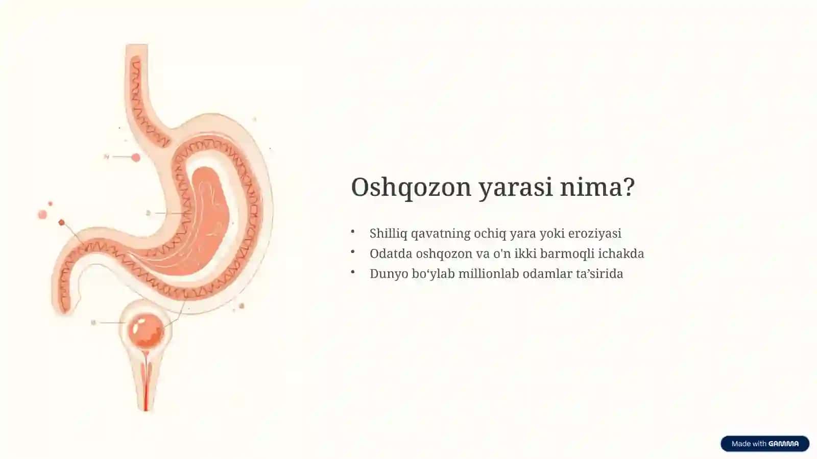 Oshqozon yarasi kasalligi: etiologiyasi va patogenizidagi zamonaviy aspektlar 2