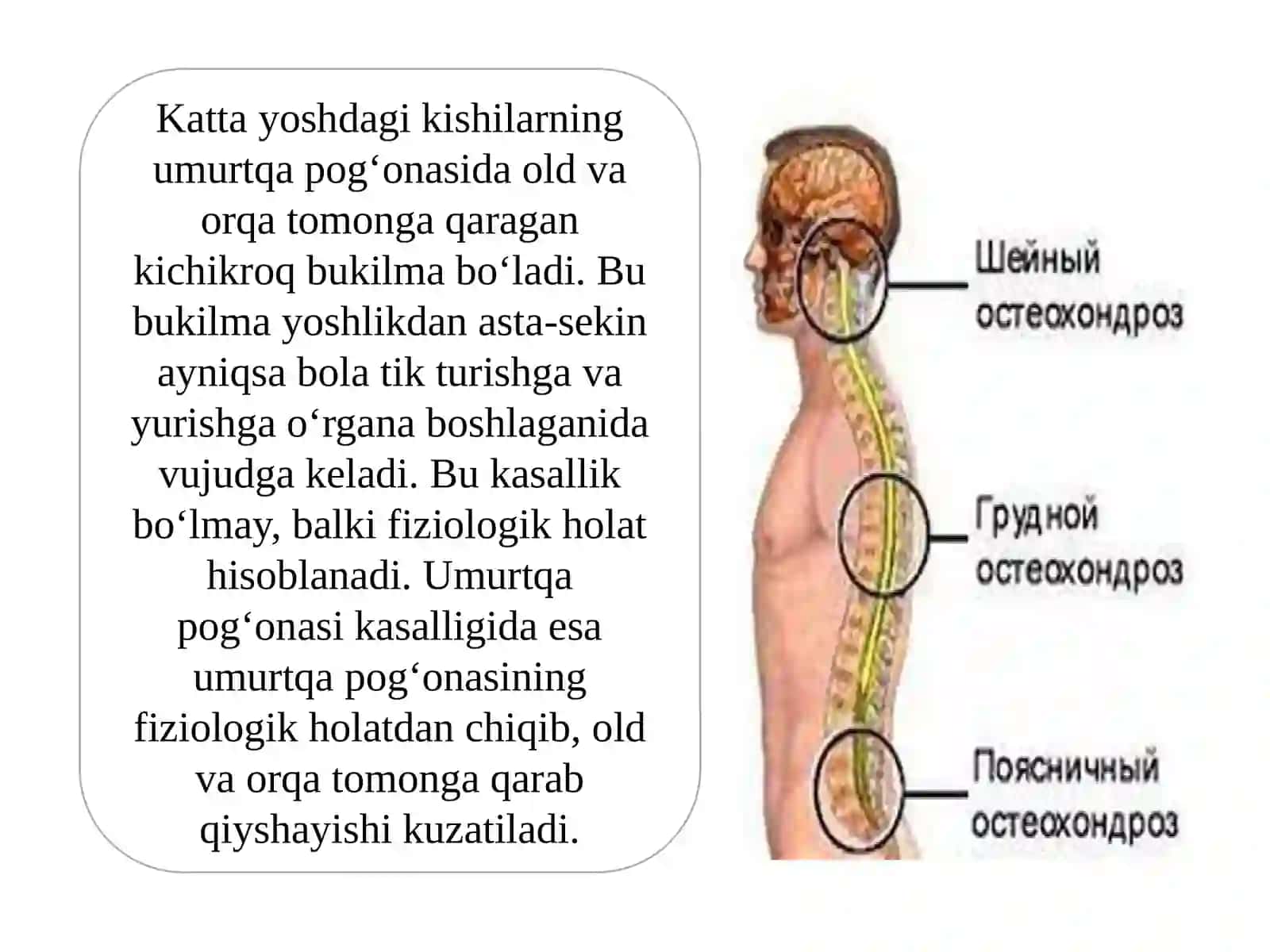 Bolalardaskeletpatologiyasi 2