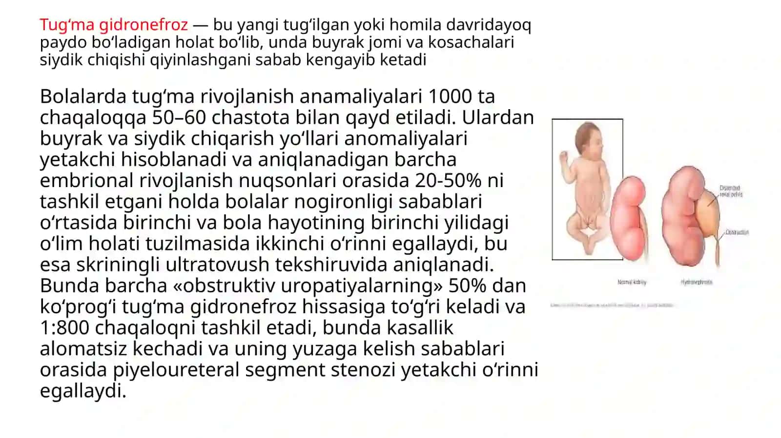 Tug’ma bolalarda gidronefrozlar 2
